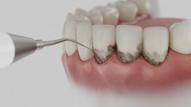 Trusted Teeth Cleaning And Checkup service in King, NC - Dentist Open Now